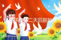 試管移植第二天后胚胎在干嘛！子宮內游走居無定所