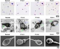 試管促排卵不同方案都適合哪些人？如何監測排卵？