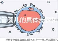試管嬰兒的具體步驟和（做試管的流程順序）