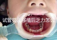 試管嬰兒移植后乏力怎么回事?匡延平主任告訴你答案