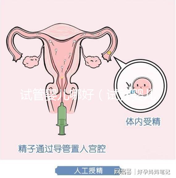 試管嬰兒哪好(試管嬰兒權威醫(yī)院哪家最好)