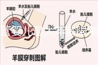 試管嬰兒最大年齡限制(試管嬰兒最大年齡限制是多少)