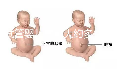 試管嬰兒費用大約多少2020年(試管嬰兒費用大約多少2020年上海)