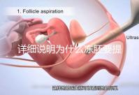 詳細說明為什么凍胚要提前一兩天解凍,有沒有影響一目了然