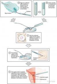 貴陽未婚子女戶口如何向婦女介紹,附2024年結(jié)算流程