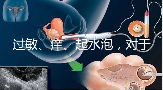 過敏、癢、起水泡,對于三伏貼的副作用你需知道該怎么辦