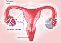 風濕關節炎(風濕關節炎的癥狀有哪些)