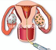 馬來(lái)西亞 試管嬰兒(馬來(lái)西亞試管嬰兒和泰國(guó)比較哪個(gè)更好)