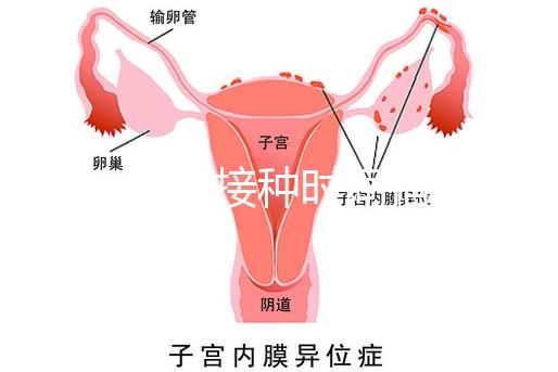 麻疹疫苗接種時(shí)間指南,初種年齡最好不要晚于這個(gè)月齡
