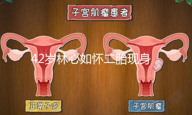 42歲林心如懷二胎現身新活動，霍建華全程陪同產檢回應