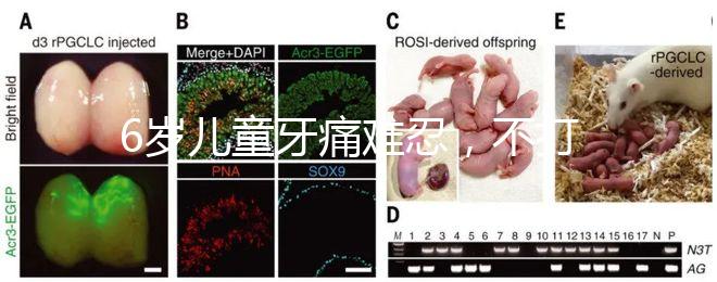 6歲兒童牙痛難忍，不打針吃藥5個小妙招快速止疼