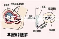 6細胞二級胚胎著床率與養囊成功率解讀,拿不準移植與否戳