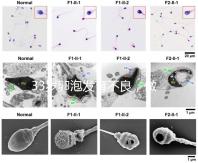 33歲卵泡發育不良,做試管黃體期促排方案失敗怎么辦?