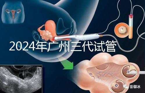2024年廣州三代試管嬰兒費用明細公布！