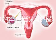2024年，武漢同濟醫院不孕癥醫生排名公布，選擇專家迅速登記