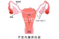 2025昆明三代試管助孕費用一覽,8-15萬元,價格透明公開自主選擇