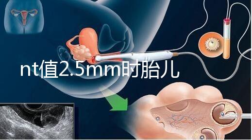 nt值2.5mm時胎兒異常幾率并不高，但羊水穿刺一定要做