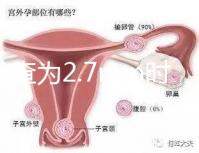 nt檢查為2.7mm時(shí)危險(xiǎn)性莫亂猜,做完無創(chuàng)后才能確定