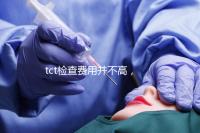 tct檢查費用并不高，不同醫院收費標準不一樣